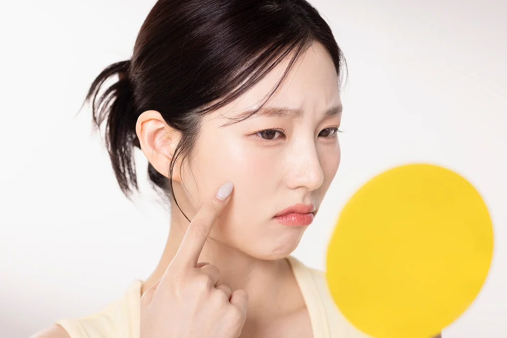 대전 다이어트 비대면 전화처방|거울을 보며 얼굴 피부 상태를 고민하는 여성